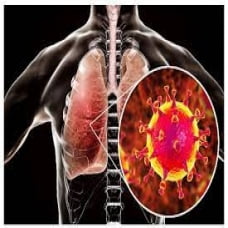Có cần thiết thải độc phổi sau nhiễm Covid-19?